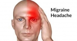 Sobanukirwa n’indwara y’umutwe w’uruhande rumwe( migraine)