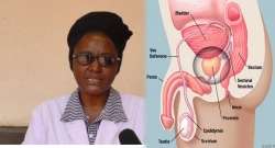 Uko wakwirinda indwara ya 'Prostate' ikomeje kwibasira abagabo-VIDEO