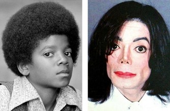 Ukuri kwihishe inyuma y'impinduka z'uruhu rwa Michael Jackson